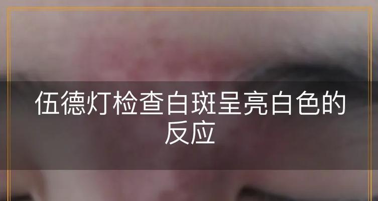 显示器白色有亮斑问题的原因与解决方法（亮斑问题对显示效果的影响及其修复技巧）